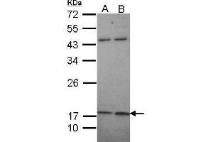 WB Image Sample (30 ug of whole cell lysate) A: A431 , B: H1299 12% SDS PAGE antibody diluted at 1:1000 (KCNMB1 Antikörper  (Center))
