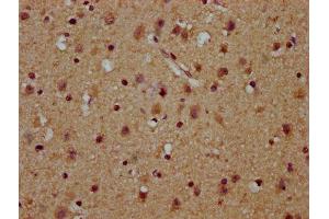 IHC image of ABIN7174180 diluted at 1:100 and staining in paraffin-embedded human brain tissue performed on a Leica BondTM system.