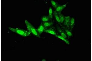 Immunofluorescence (IF) image for anti-Forkhead Box E1 (Thyroid Transcription Factor 2) (FOXE1) (AA 184-365) antibody (ABIN7153034)