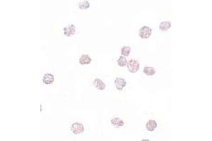Immunohistochemistry (IHC) image for anti-SRY (Sex Determining Region Y)-Box 2 (SOX2) (N-Term) antibody (ABIN1031582) (SOX2 Antikörper  (N-Term))