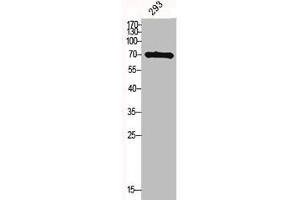 Western Blot analysis of 293 cells using Midline-1 Polyclonal Antibody (MID1 Antikörper  (N-Term))