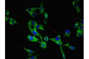 Immunofluorescent analysis of Hela cells using ABIN7168440 at dilution of 1:100 and Alexa Fluor 488-congugated AffiniPure Goat Anti-Rabbit IgG(H+L) (ROBO1 Antikörper  (AA 29-143))