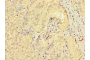 Immunohistochemistry of paraffin-embedded human adrenal gland tissue using ABIN7171870 at dilution of 1:100 (TSPAN32 Antikörper  (AA 111-202))
