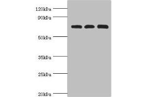 Western blot All lanes: Calcium-binding mitochondrial carrier protein Aralar2 antibody at 4 μg/mL Lane 1: Mouse liver tissue Lane 2: Mouse kidney tissue Lane 2: HepG2 whole cell lysate Secondary Goat polyclonal to rabbit IgG at 1/10000 dilution Predicted band size: 74 kDa Observed band size: 74 kDa (slc25a13 Antikörper  (AA 1-300))