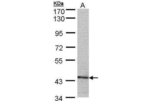 PSMC6 Antikörper