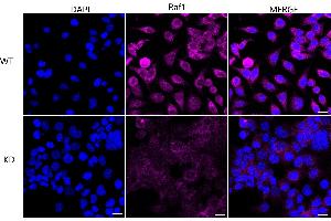 Immunocytochemical staining of HeLa cells using Raf1 antibody (ABIN7800800), 1:1,000), Top panel: wild-type (WT), Bottom panal: Raf1 shRNA knockdown (KD). (Rekombinanter RAF1 Antikörper)