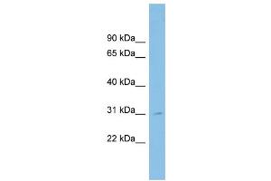 WB Suggested Anti-SPATA9 Antibody Titration: 0. (SPATA9 Antikörper  (N-Term))