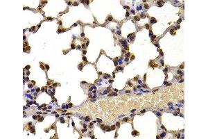 Immunohistochemistry of paraffin-embedded Mouse lung using WHSC1 Polyclonal Antibody at dilution of 1:100 (40x lens). (WHSC1 Antikörper)