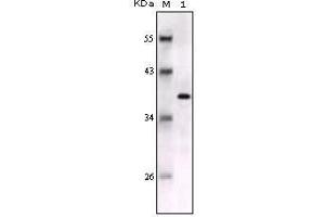 Western blot analysis using S100B mouse mAb against full-length S100B recombinant protein.