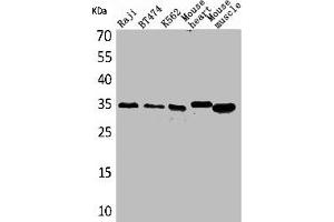 Western Blot analysis of Raji BT474 K562 mouse heart mouse skeletal muscle cells using Claudin-17 Polyclonal Antibody (Claudin 17 Antikörper  (C-Term))