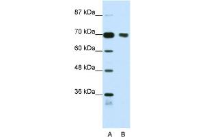 WB Suggested Anti-TRIM32 Antibody Titration:  1. (TRIM32 Antikörper  (N-Term))