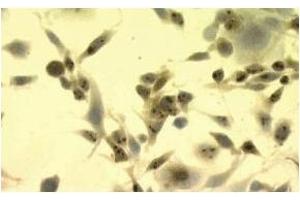 Immunohistochemistry (IHC) image for anti-Heat Shock Protein 70 (HSP70) antibody (ABIN263937) (HSP70 Antikörper)