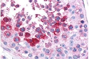 Human Testis: Formalin-Fixed, Paraffin-Embedded (FFPE)