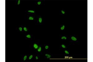 Immunofluorescence of monoclonal antibody to CCNH on HeLa cell. (Cyclin H Antikörper  (AA 1-110))
