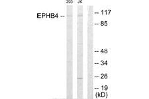Western blot analysis of extracts from Jurkat/293 cells, using EPHB4 Antibody.