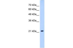 Western Blotting (WB) image for anti-Solute Carrier Family 25 (Mitochondrial Carrier, Brain), Member 14 (SLC25A14) antibody (ABIN2462743)