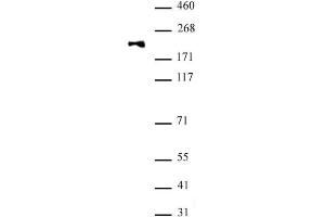 DNMT1 monomethyl Lys142 antibody (pAb) tested by Western blot. (DNMT1 Antikörper)