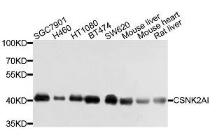 Western blot analysis of extracts of various cell lines, using CSNK2A1 antibody. (CSNK2A1/CK II alpha Antikörper  (AA 1-391))