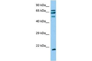 Host: Rabbit Target Name: ANKRD60 Sample Type: Fetal Liver lysates Antibody Dilution: 1. (ANKRD60 Antikörper  (C-Term))