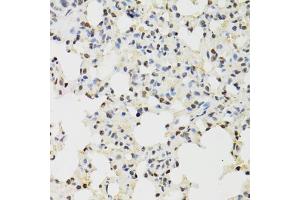 Immunohistochemistry of paraffin-embedded mouse lung using KDM4A antibody. (KDM4A Antikörper)