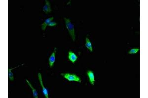 Immunofluorescent analysis of U251 cells using ABIN7149746 at dilution of 1:100 and Alexa Fluor 488-congugated AffiniPure Goat Anti-Rabbit IgG(H+L) (DSE Antikörper  (AA 23-270))