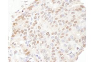 anti-Trichorhinophalangeal Syndrome I (TRPS1) (AA 1000-1050) antibody