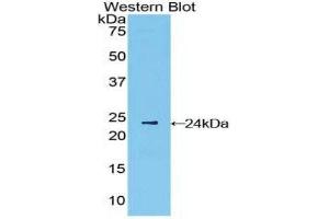 Western Blotting (WB) image for anti-Interferon, beta 1, Fibroblast (IFNB1) (AA 22-187) antibody (ABIN3209026) (IFNB1 Antikörper  (AA 22-187))
