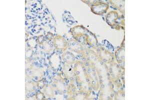 Immunohistochemistry of paraffin-embedded rat kidney using TGM5 antibody. (Transglutaminase 5 Antikörper  (AA 461-720))