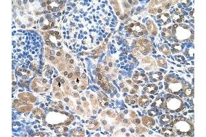 SLC7A14 antibody was used for immunohistochemistry at a concentration of 4-8 ug/ml to stain EpitheliaI cells of renal tubule (arrows) in Human Kidney. (SLC7A14 Antikörper)
