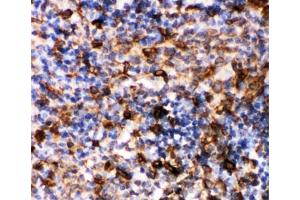 Immunohistochemistry (IHC) image for anti-Caspase 6, Apoptosis-Related Cysteine Peptidase (CASP6) (AA 7-27) antibody (ABIN3030314)