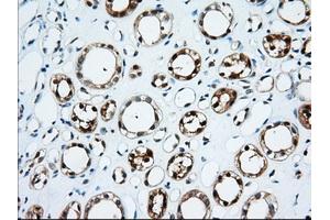 Immunohistochemical staining of paraffin-embedded Human thyroid tissue using anti-TTC32 mouse monoclonal antibody. (TTC32 Antikörper)