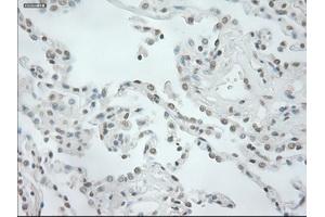 Immunohistochemical staining of paraffin-embedded prostate tissue using anti-NEUROG1mouse monoclonal antibody. (Neurogenin 1 Antikörper)