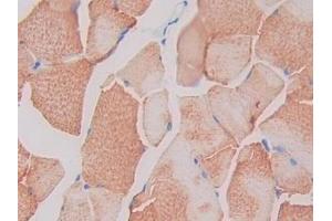 Immunohistochemistry (IHC) image for anti-Single Immunoglobulin and Toll-Interleukin 1 Receptor (TIR) Domain (SIGIRR) (AA 1-118) antibody (ABIN7437206)