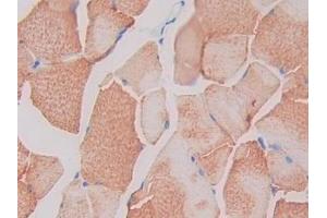 Detection of SIGIRR in Rat Skeletal muscle Tissue using Polyclonal Antibody to Single Ig IL1 Related Receptor (SIGIRR) (SIGIRR Antikörper  (AA 1-118))