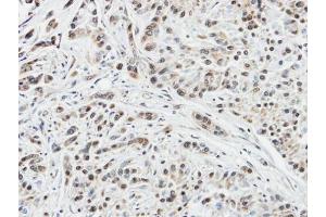 IHC-P Image Immunohistochemical analysis of paraffin-embedded A549 xenograft, using DUSP10, antibody at 1:100 dilution. (DUSP10 Antikörper  (C-Term))