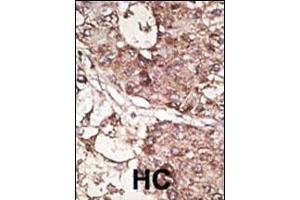 Immunohistochemistry (Paraffin-embedded Sections) (IHC (p)) image for anti-CD90 (THY1) (AA 36-65), (N-Term) antibody (ABIN388803)