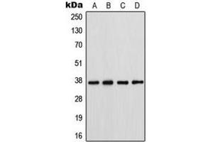 Western blot analysis of Connexin 37 expression in HeLa (A), SW620 (B), A431 (C), NIH3T3 (D) whole cell lysates. (GJA4 Antikörper  (Center))