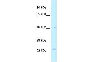 WB Suggested Anti-MRPL40 Antibody Titration: 1. (MRPL40 Antikörper  (Middle Region))