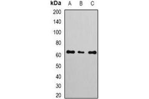 Western blot analysis of NERF expression in A549 (A), MCF7 (B), Jurkat (C) whole cell lysates. (ELF2 Antikörper)