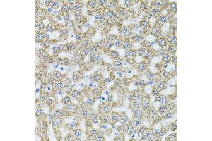 Immunohistochemistry of paraffin-embedded rat liver using MTTP antibody (ABIN5970876) at dilution of 1/100 (40x lens). (MTTP Antikörper)