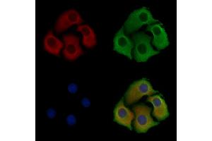 ABIN6257715 and ABIN6275291 staining Hela cells by IF/ICC.