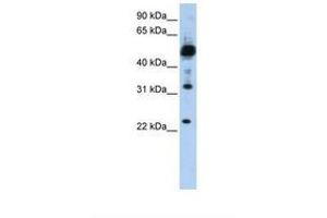 TMEM38B antibody  (C-Term)