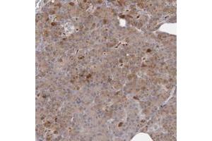 Immunohistochemical staining of human pancreas with ANKRD44 polyclonal antibody  shows moderate cytoplasmic positivity in exocrine cells.