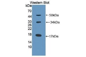 Western Blotting (WB) image for anti-Collagen, Type X (COL10) antibody (Biotin) (ABIN1175583) (COL10 Antikörper  (Biotin))