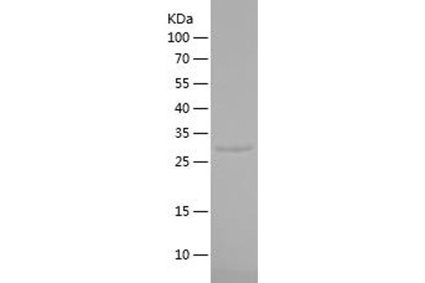 SLC30A8 Protein (AA 1-79) (His-IF2DI Tag)