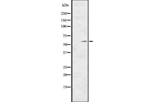 Western blot analysis of Phospho-PKM2 (Tyr105) using K562 whole cell lysates (PKM Antikörper  (pTyr105))