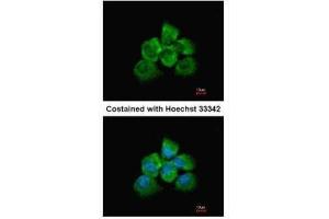 ICC/IF Image Immunofluorescence analysis of methanol-fixed A431, using ARHGEF18, antibody at 1:200 dilution. (ARHGEF18 Antikörper  (Center))