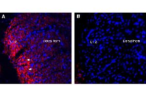 Expression of Semaphorin 6A in rat spinal cord.