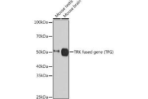 TFG Antikörper