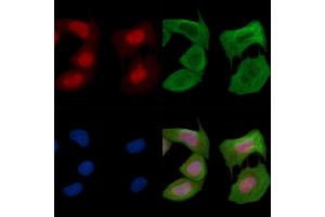 ABIN6255430 and ABIN6267624 staining Hela cells(30 min of UV treatment) by IF/ICC.